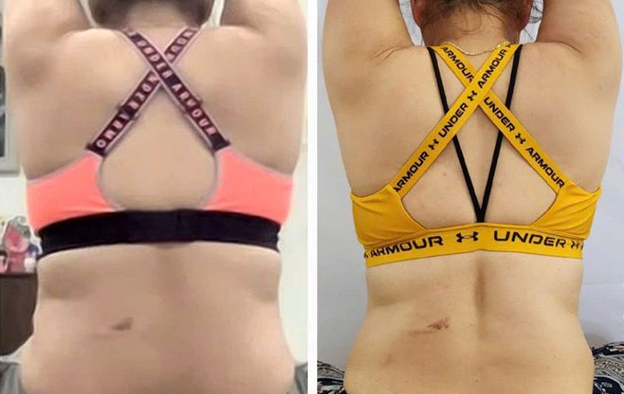 NNCB là một mô hình đã được chứng minh