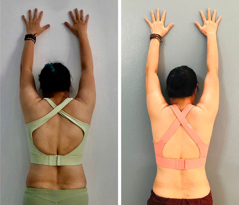 HÀNH TRÌNH CHUYỂN HÓA SỨC KHỎE CÂU CHUYỆN CỦA CÔ TUYẾT