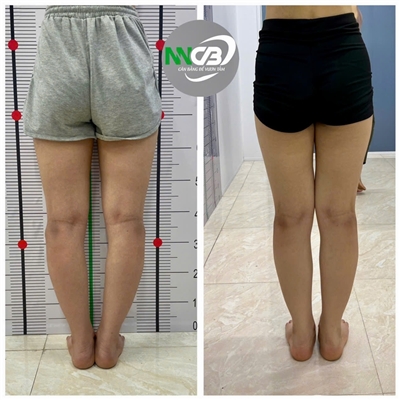 18 tuổi, nhẽ ra là tuổi đẹp nhất! Nhưng tôi đã tự huỷ hoại bản thân mình!